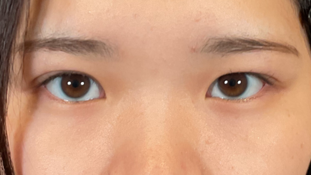 Postoperative Condition Part 1