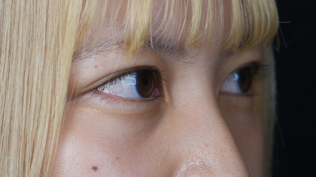 Postoperative Condition Part 1