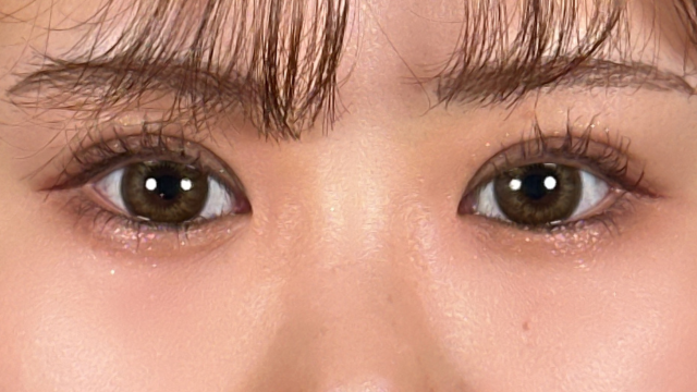 Postoperative Condition Part 1