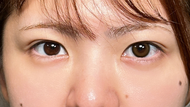 Postoperative Condition Part 1