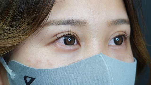 Postoperative Condition Part 1