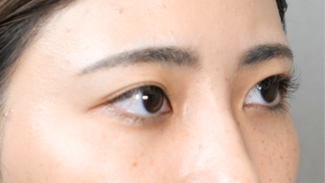 Postoperative Condition Part 1