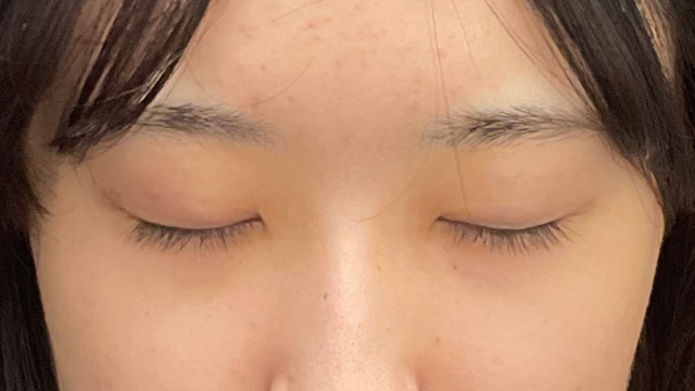 Postoperative Condition Part 1