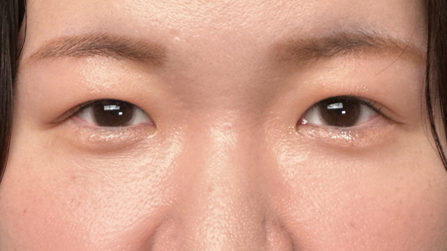 Postoperative Condition Part 1