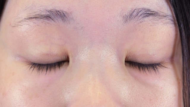 Postoperative Condition Part 1