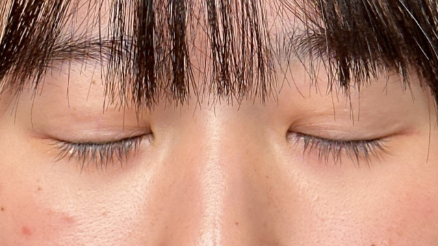 Postoperative Condition Part 1