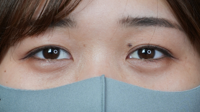 Postoperative Condition Part 1