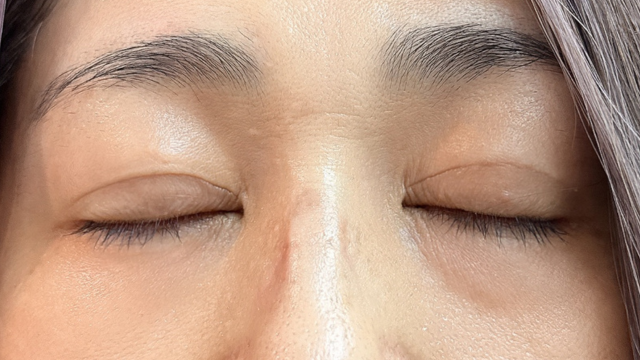 Postoperative Condition Part 1