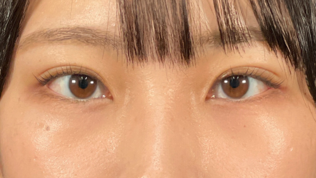 Postoperative Condition Part 1