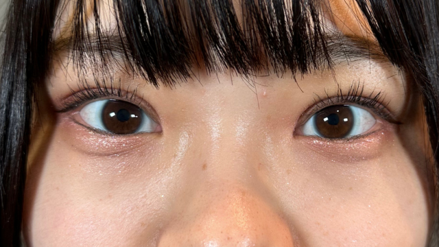 Postoperative Condition Part 1