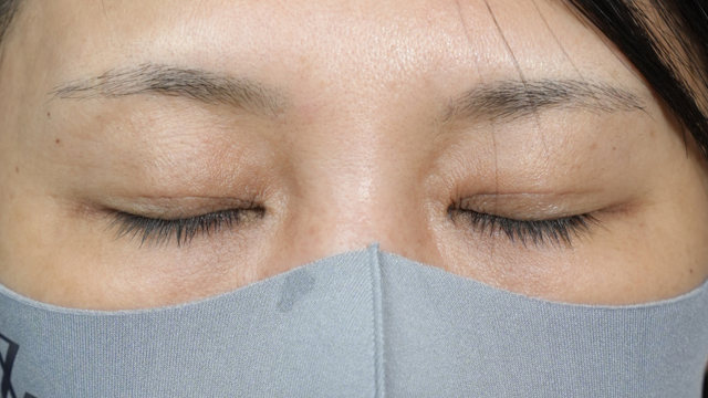 Postoperative Condition Part 1