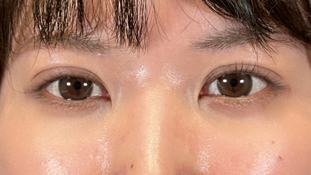 Postoperative Condition Part 1