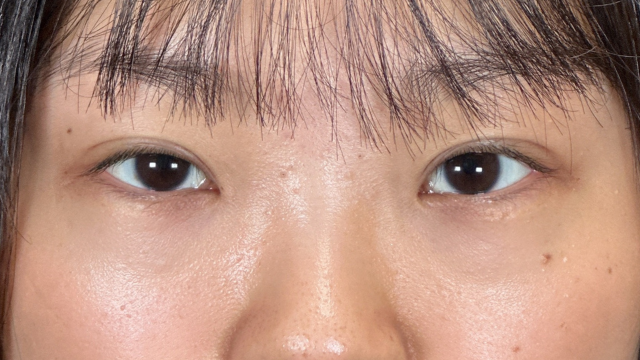 Postoperative Condition Part 1