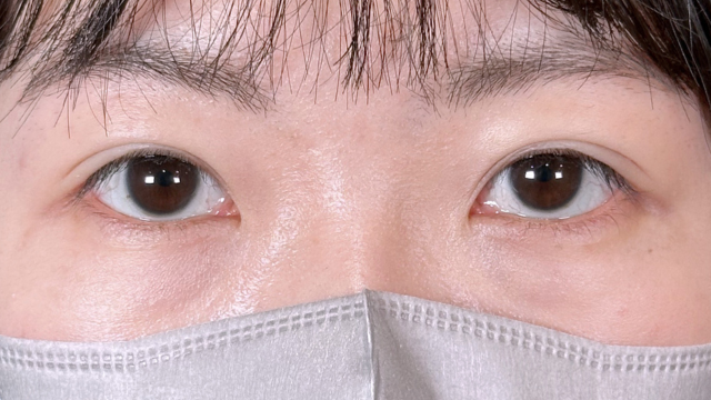 Postoperative Condition Part 1