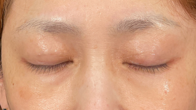 Postoperative Condition Part 1