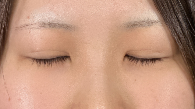 Postoperative Condition Part 1