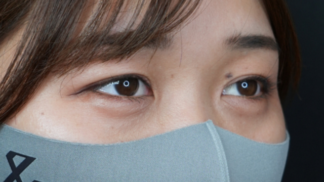 Postoperative Condition Part 1