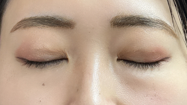 Postoperative Condition Part 1