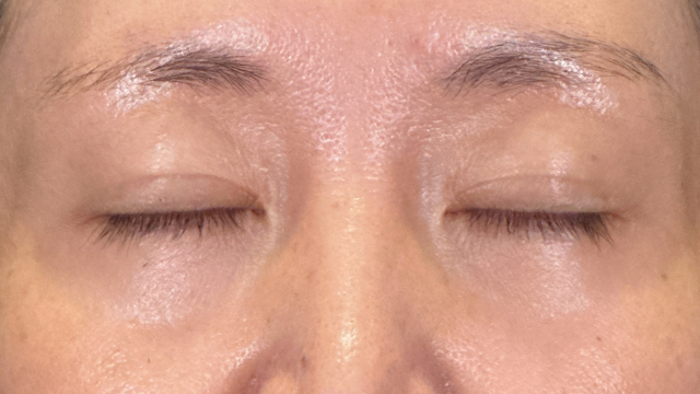 Postoperative Condition Part 1