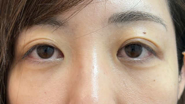 Postoperative Condition Part 1