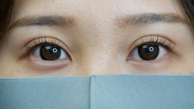 Postoperative Condition Part 1