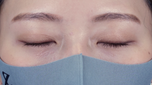 Postoperative Condition Part 1