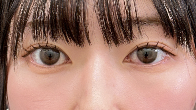 Postoperative Condition Part 1