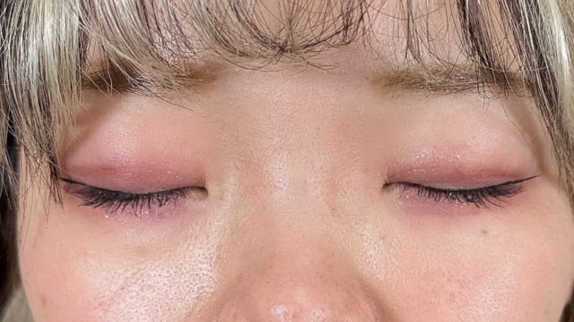 Postoperative Condition Part 1