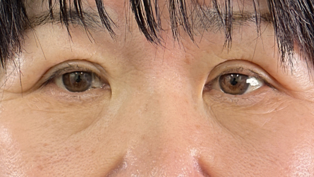 Postoperative Condition Part 1