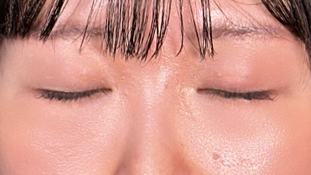 Postoperative Condition Part 1