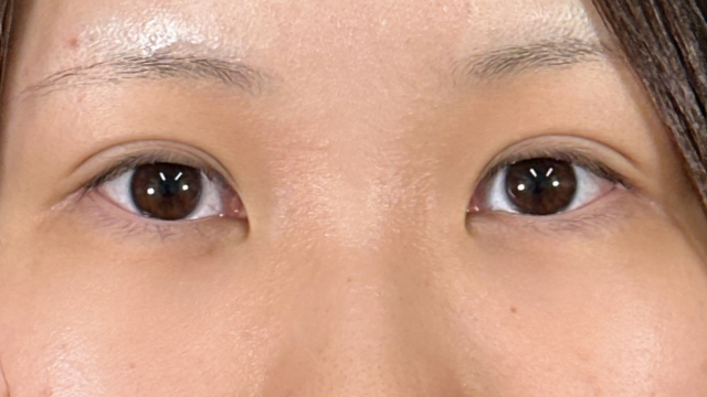 Postoperative Condition Part 1