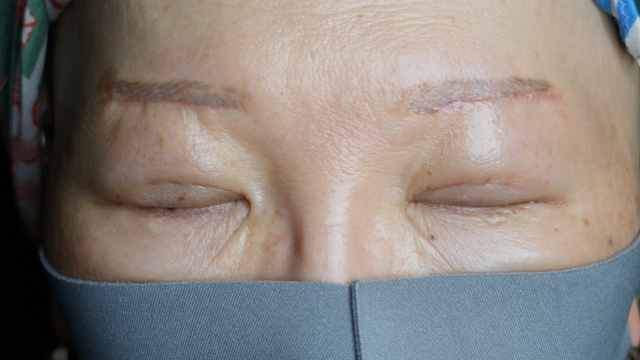 Postoperative Condition Part 1