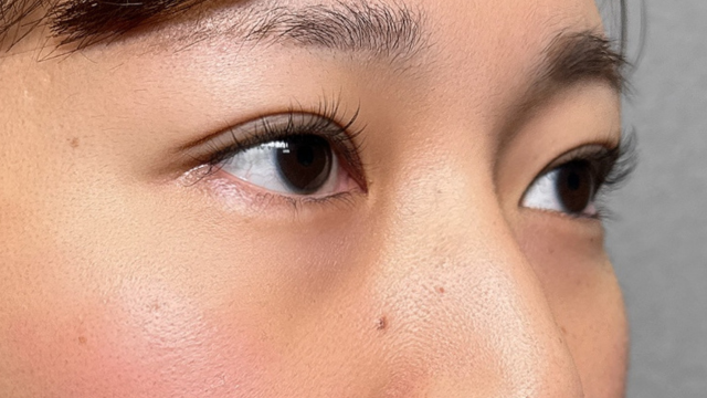 Postoperative Condition Part 1