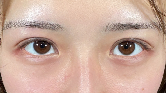 Postoperative Condition Part 1