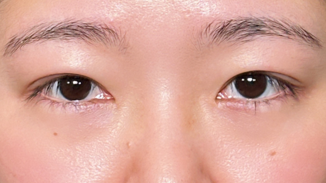 Postoperative Condition Part 1