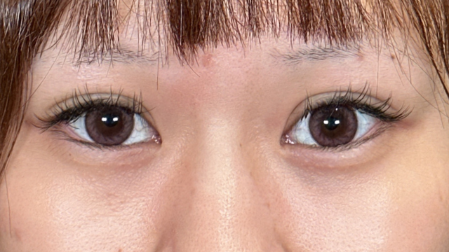 Postoperative Condition Part 1