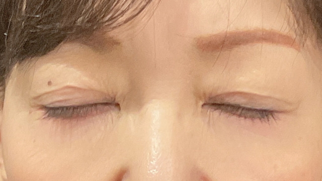 Postoperative Condition Part 1