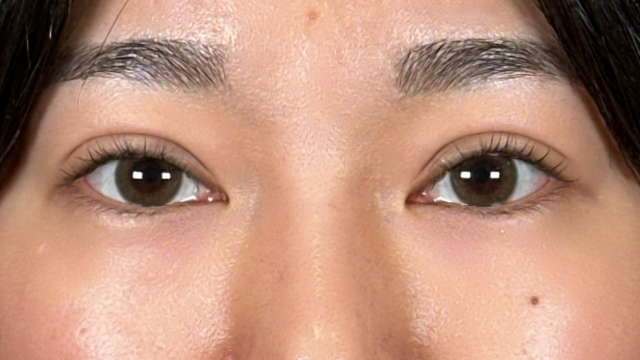 Postoperative Condition Part 1