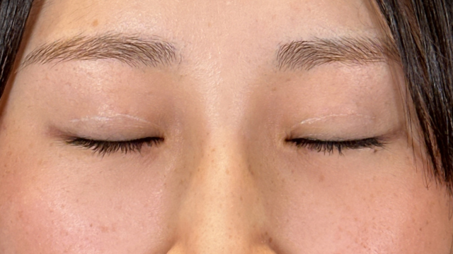 Postoperative Condition Part 1