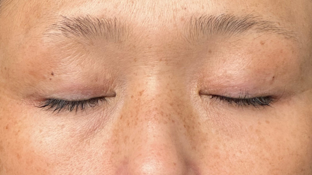 Postoperative Condition Part 1