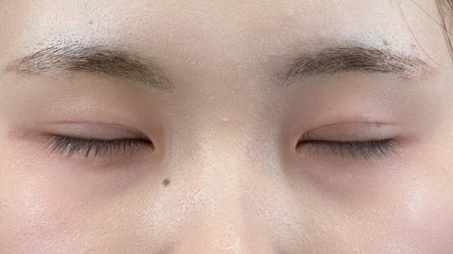 Postoperative Condition Part 1