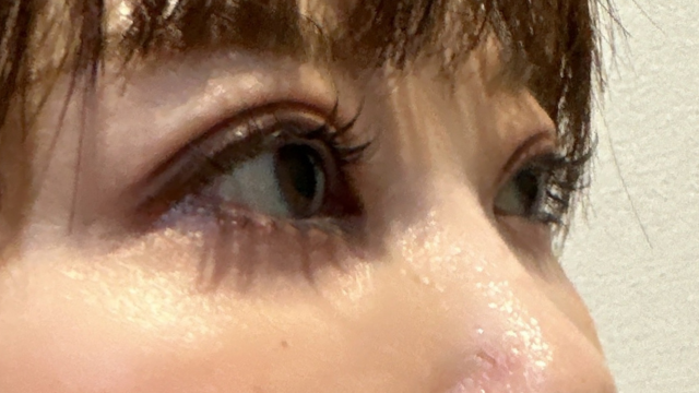 Postoperative Condition Part 1