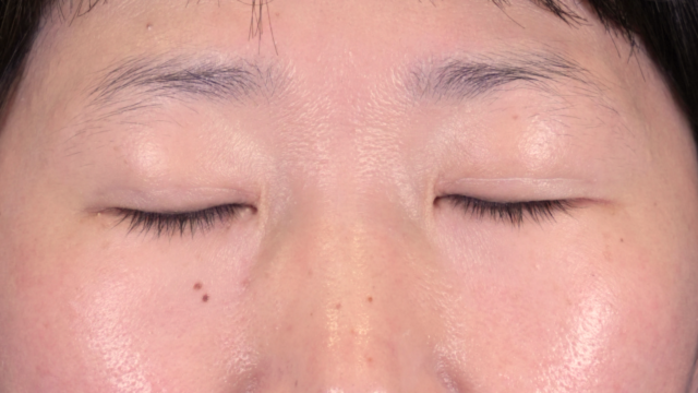 Postoperative Condition Part 1