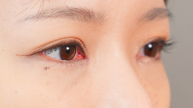 Postoperative Condition Part 1