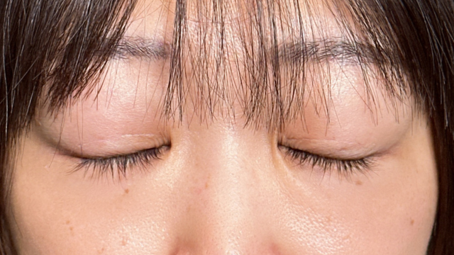 Postoperative Condition Part 1