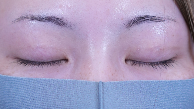 Postoperative Condition Part 1