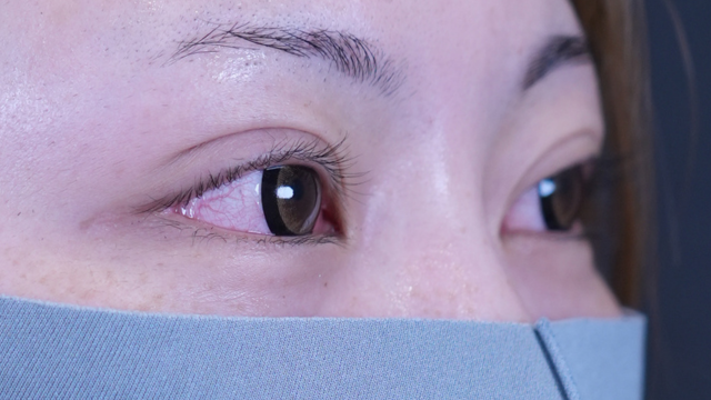 Postoperative Condition Part 1