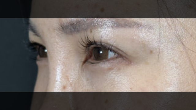 Postoperative Condition Part 1