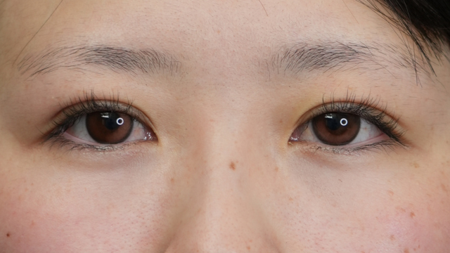 Postoperative Condition Part 1