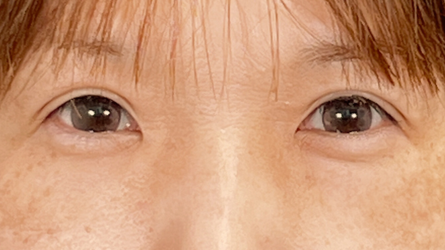 Postoperative Condition Part 1